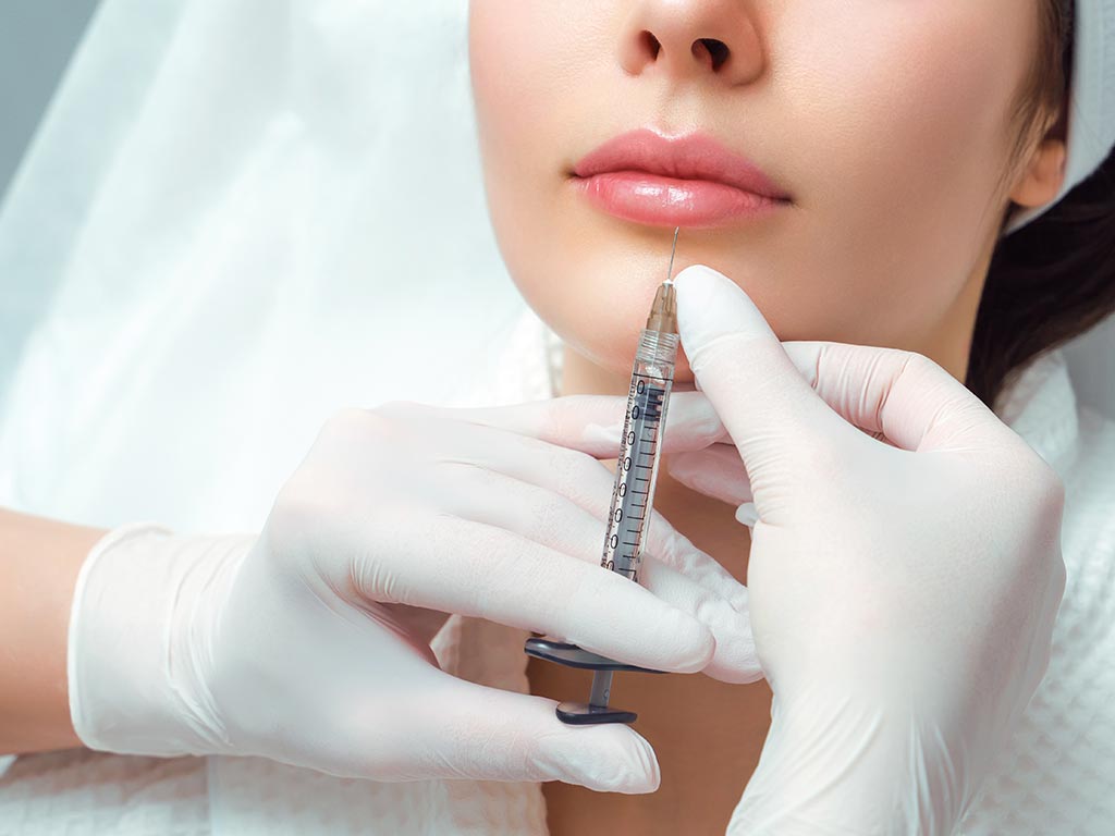 Close de mão de dermatologista aplicando um preenchimento dérmico no lábio de paciente mulher.